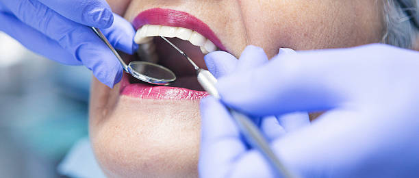 Best Emergency Broken Tooth Repair in Warson Woods, MO